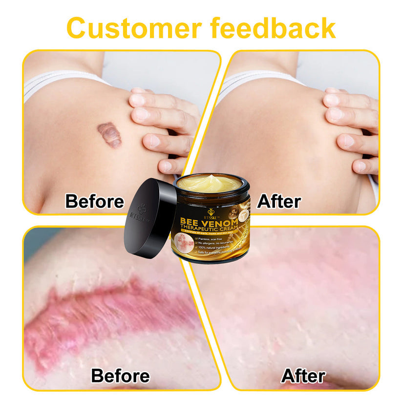 Bee Venom Skin Creamπ₯π³πππ π
ππ πππππππππ 7π% πππ