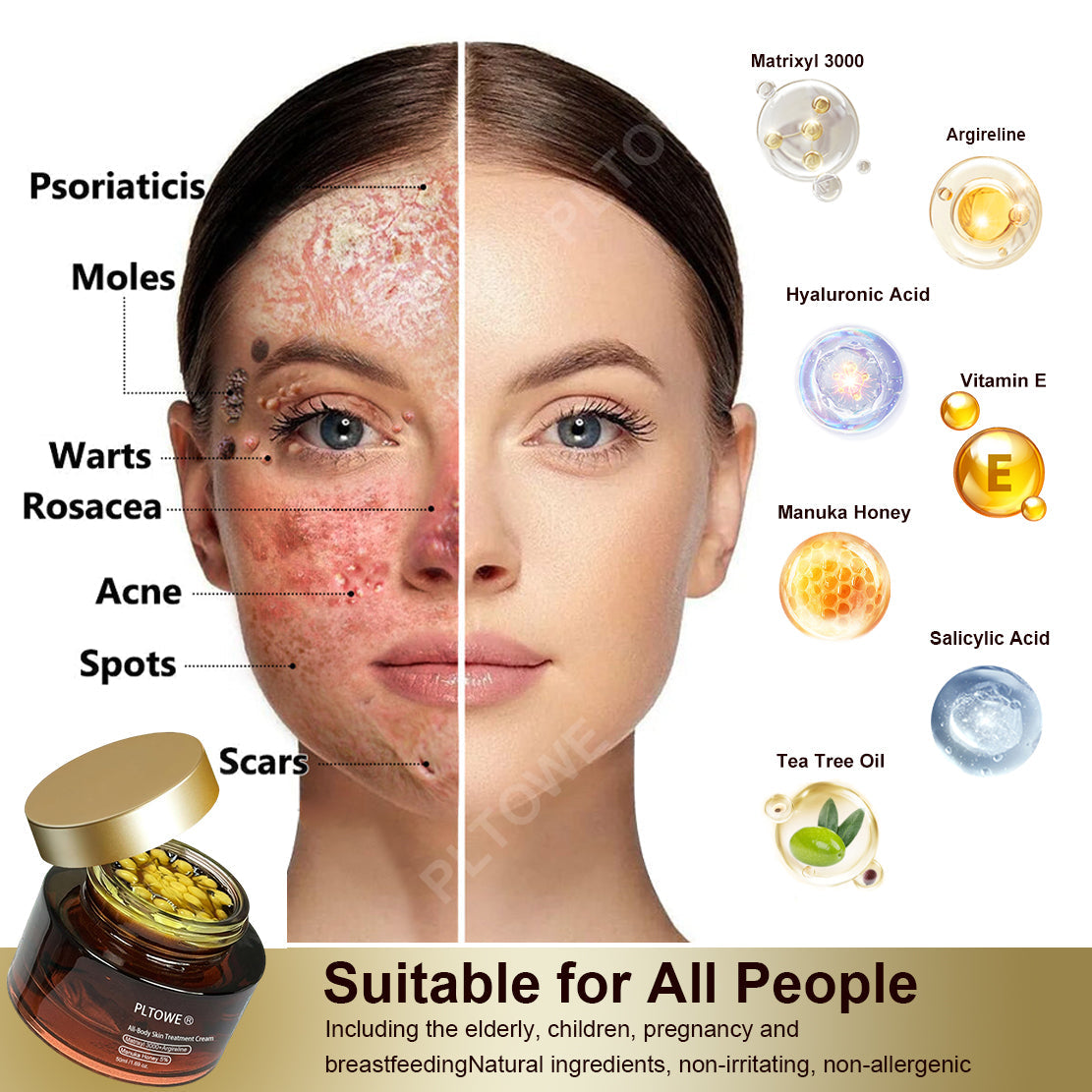 Powerful All-Body Skin Treatment Cream (BIGGEST DISCOUNT)
