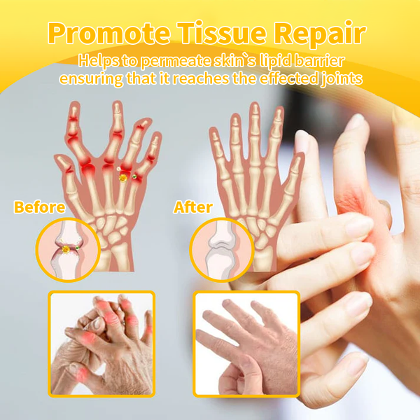 Bee Venom & Turmeric Arthritis Therapy Cream 👩🔬Specializing in orthopedic conditions and joint pain