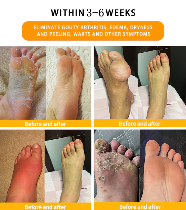 30-Herb Foot - (👩⚕️AVLS Certification)