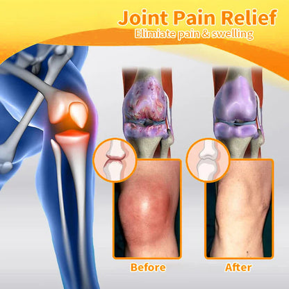 Bee Venom Joint and Bone Pain Relief Cream