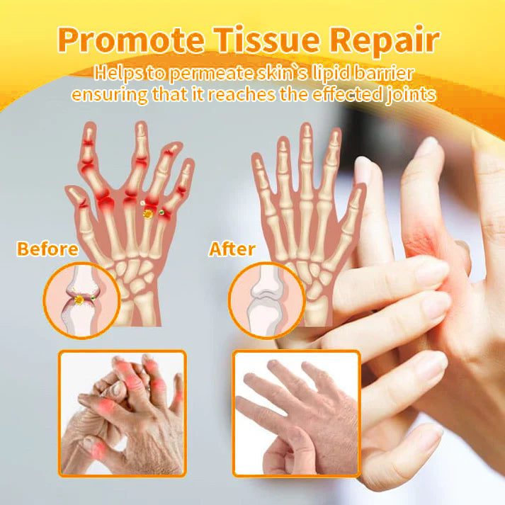 Bee Venom Joint and Bone Pain Relief Cream