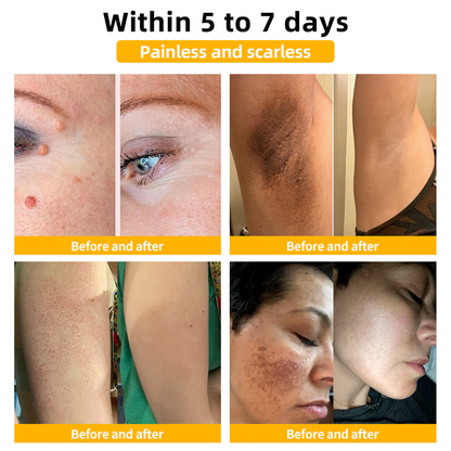 Advanced Bee Venom Skin Cream👨‍⚕️🌿(🔥𝑳𝒂𝒔𝒕 𝒅𝒂𝒚 𝒑𝒓𝒐𝒎𝒐𝒕𝒊𝒐𝒏 8𝟎% 𝒐𝒇𝒇)