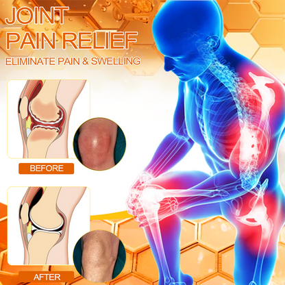 Official Store: Aetheris™ Bee Venom Instant Ultra Strength Pain Relief Therapy Cream-(Provides pain eliminate for Arthritis, Muscle, Back Pain, Knees, Back, Shoulders, Hips, Wrists, Hands)