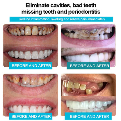 𝐒𝐢𝐥𝐢𝐜𝐨𝐧𝐞 𝐑𝐞𝐥𝐢𝐧𝐞 𝐃𝐞𝐧𝐭𝐮𝐫𝐞 𝐒𝐞𝐭 (⏰𝐋𝐢𝐦𝐢𝐭𝐞𝐝 𝐭𝐢𝐦𝐞 𝐝𝐢𝐬𝐜𝐨𝐮𝐧𝐭 𝐋𝐚𝐬𝐭 𝟑𝟎 𝐦𝐢𝐧𝐮𝐭𝐞𝐬⏰)