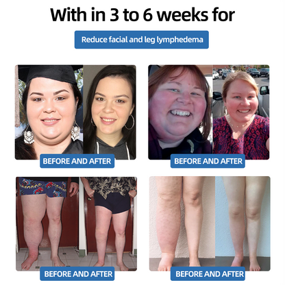 𝗣𝗼𝗿𝘁𝗮𝗯𝗹𝗲 𝗟𝘆𝗺𝗽𝗵𝗮𝘁𝗶𝗰 𝗦𝗼𝗼𝘁𝗵𝗶𝗻𝗴 𝗕𝗼𝗱𝘆 𝗦𝗵𝗮𝗽𝗶𝗻𝗴 𝗨𝗹𝘁𝗿𝗮𝘀𝗼𝘂𝗻𝗱 𝗜𝗻𝘀𝘁𝗿𝘂𝗺𝗲𝗻𝘁 𝗳𝗼𝗿 𝗡𝗲𝗰𝗸
