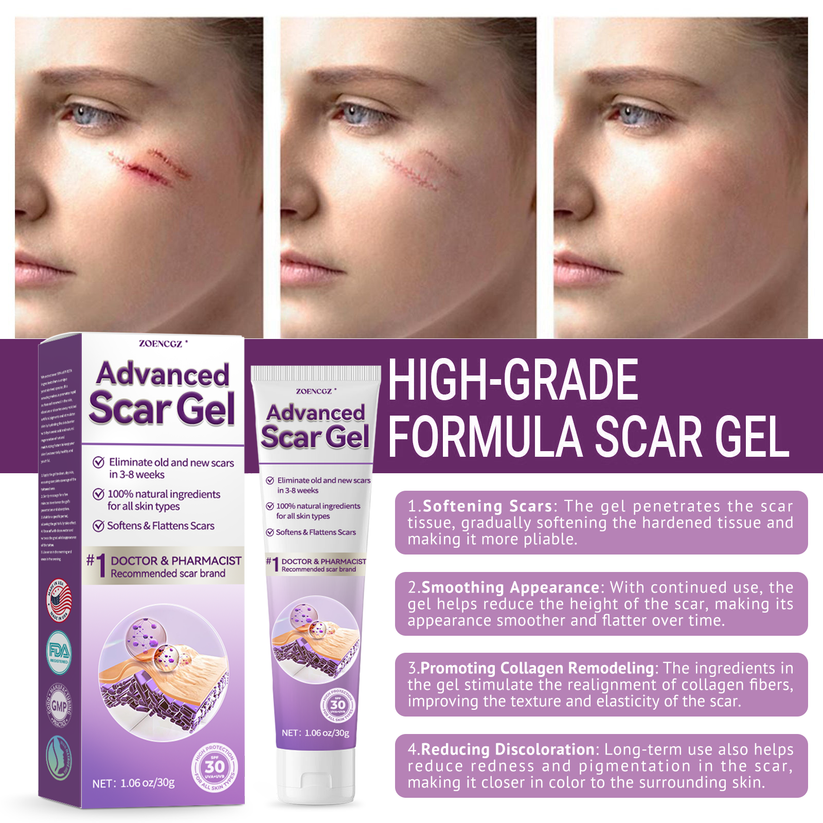 [Limited time discount sale🔥] Advanced Scar Gel