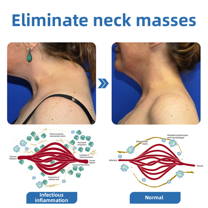 𝗣𝗼𝗿𝘁𝗮𝗯𝗹𝗲 𝗟𝘆𝗺𝗽𝗵𝗮𝘁𝗶𝗰 𝗦𝗼𝗼𝘁𝗵𝗶𝗻𝗴 𝗕𝗼𝗱𝘆 𝗦𝗵𝗮𝗽𝗶𝗻𝗴 𝗨𝗹𝘁𝗿𝗮𝘀𝗼𝘂𝗻𝗱 𝗜𝗻𝘀𝘁𝗿𝘂𝗺𝗲𝗻𝘁 𝗳𝗼𝗿 𝗡𝗲𝗰𝗸