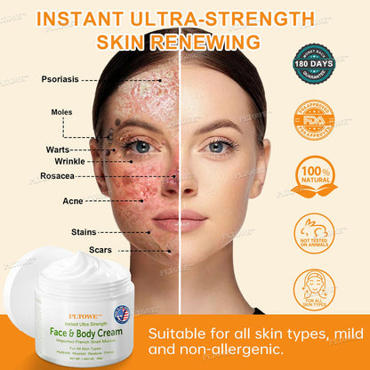 Ultra-Strength Face & Body Renewing Cream