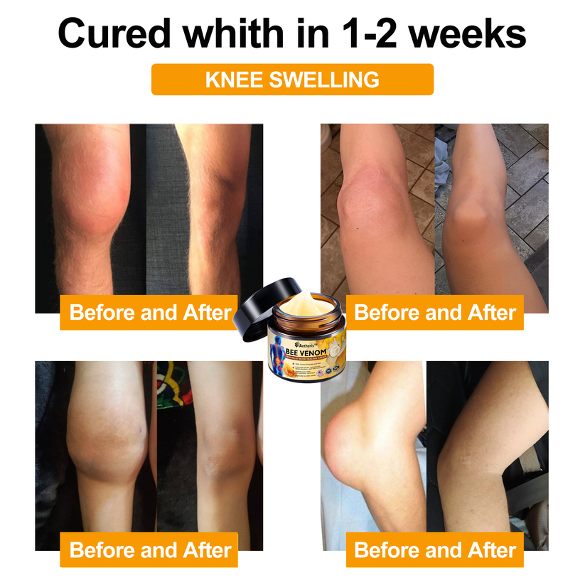 Official Store: Aetheris™ Bee Venom Instant Ultra Strength Pain Relief Therapy Cream-(Provides pain eliminate for Arthritis, Muscle, Back Pain, Knees, Back, Shoulders, Hips, Wrists, Hands)
