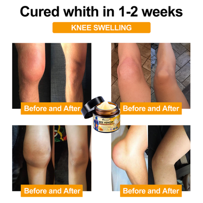 Official Store: Aetheris™ Bee Venom Instant Ultra Strength Pain Relief Therapy Cream-(Provides pain eliminate for Arthritis, Muscle, Back Pain, Knees, Back, Shoulders, Hips, Wrists, Hands)