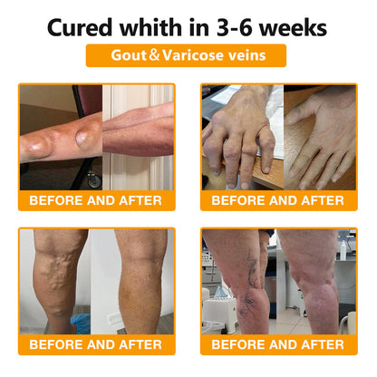 Bee-Venom Pain Relief Bone Healing Cream