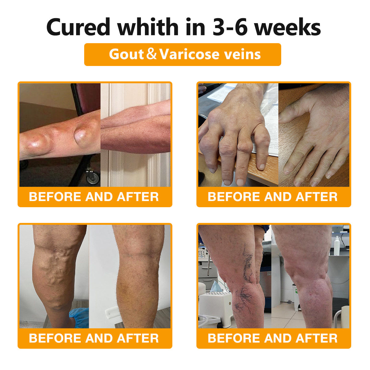 Bee-Venom Pain Relief Bone Healing Cream