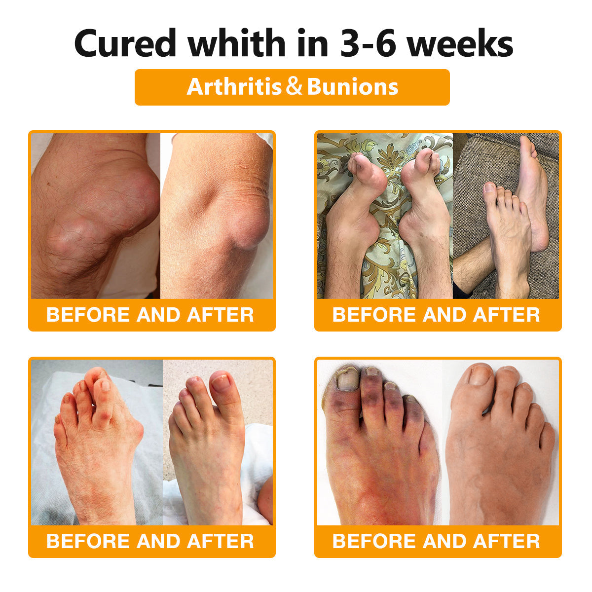 Bee-Venom Pain Relief Bone Healing Cream