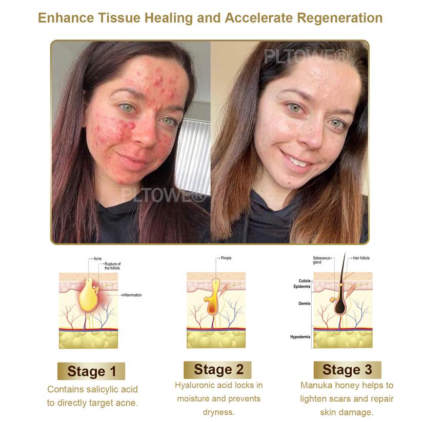 Powerful All-Body Skin Treatment Cream (BIGGEST DISCOUNT)