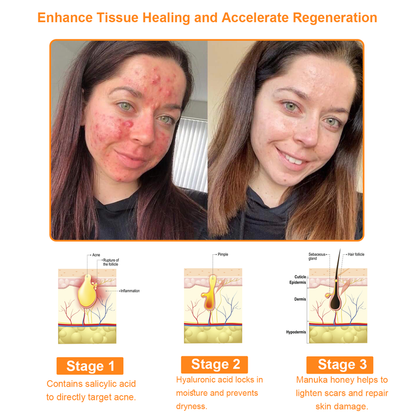 Powerful All-Body Skin Treatment Cream [👑Official Store]
