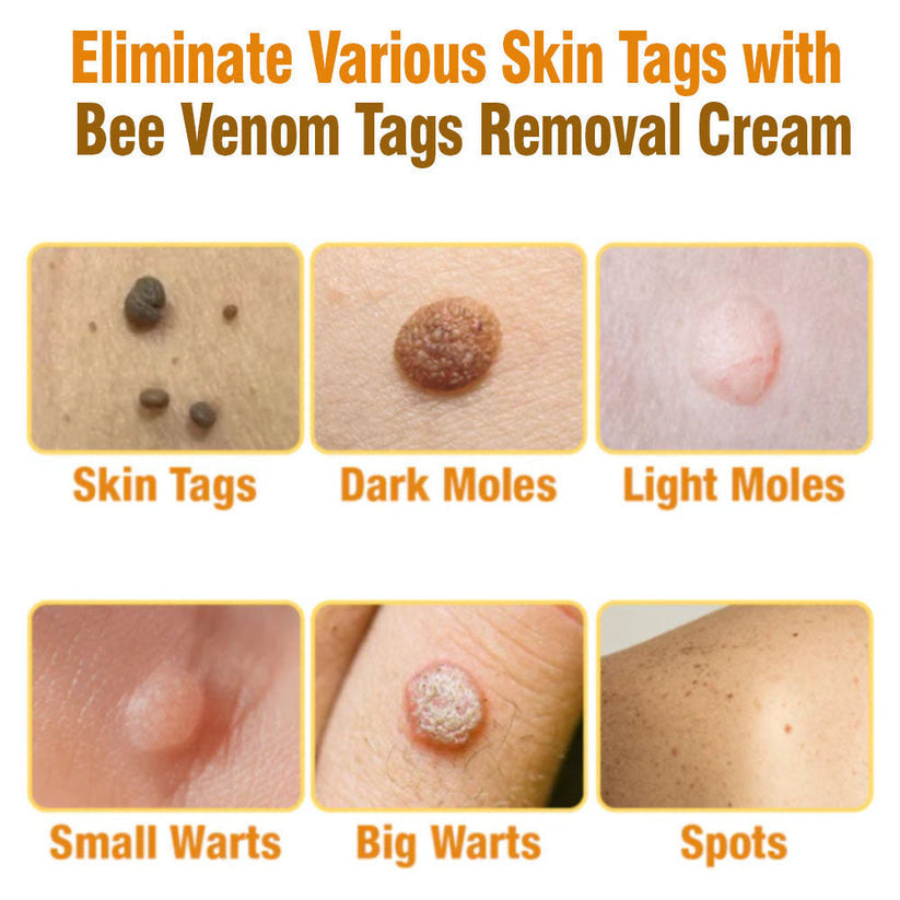 Advanced Bee Venom Skin Cream👨‍⚕️🌿(🔥𝑳𝒂𝒔𝒕 𝒅𝒂𝒚 𝒑𝒓𝒐𝒎𝒐𝒕𝒊𝒐𝒏 8𝟎% 𝒐𝒇𝒇)