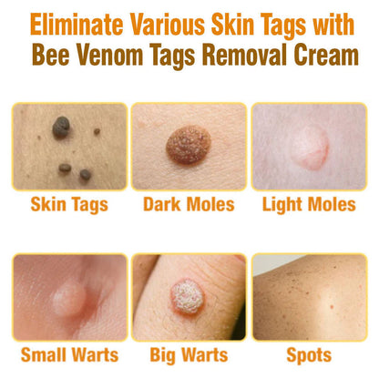 Advanced Bee Venom Skin Cream👨‍⚕️🌿(🔥𝑳𝒂𝒔𝒕 𝒅𝒂𝒚 𝒑𝒓𝒐𝒎𝒐𝒕𝒊𝒐𝒏 8𝟎% 𝒐𝒇𝒇)