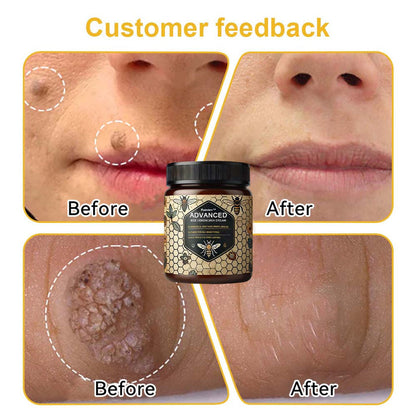 Advanced Bee Venom Skin Cream👨‍⚕️🌿(🔥𝑳𝒂𝒔𝒕 𝒅𝒂𝒚 𝒑𝒓𝒐𝒎𝒐𝒕𝒊𝒐𝒏 8𝟎% 𝒐𝒇𝒇)