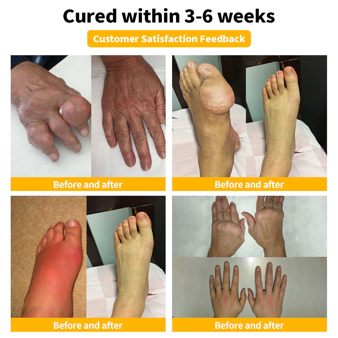Bee-Venom Pain Relief Bone Healing Cream 🐝(Specially for older adults & AA0S recommends)