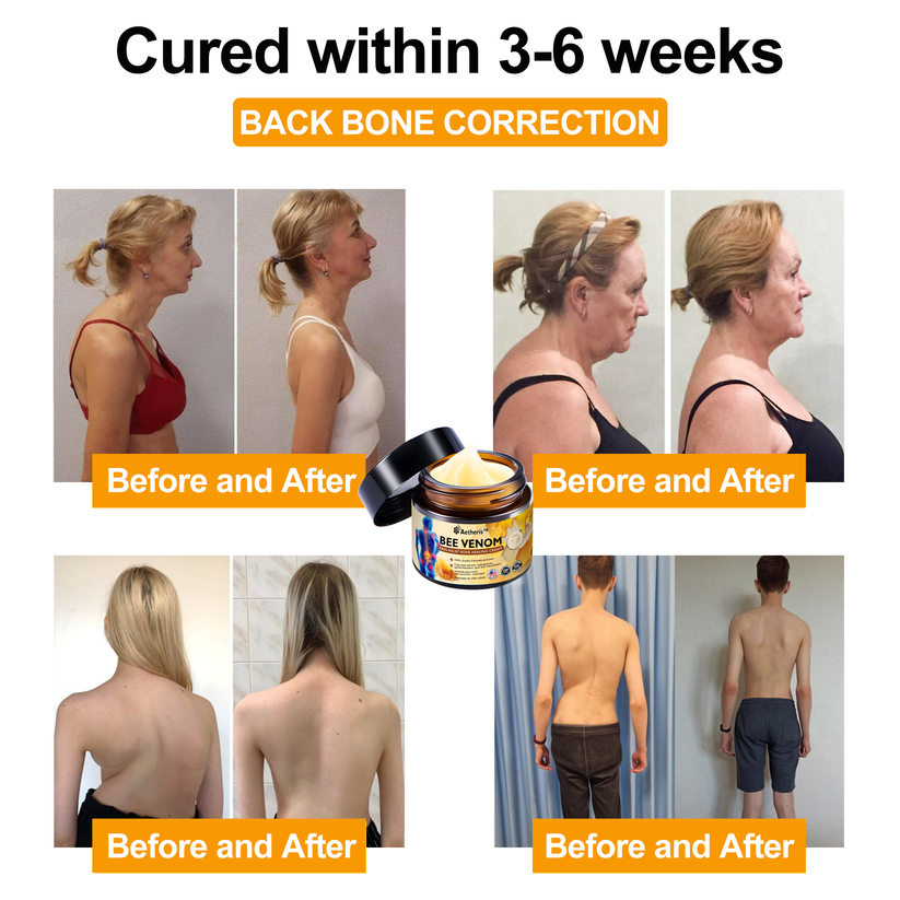 Official Store: Aetheris™ Bee Venom Instant Ultra Strength Pain Relief Therapy Cream-(Provides pain eliminate for Arthritis, Muscle, Back Pain, Knees, Back, Shoulders, Hips, Wrists, Hands)