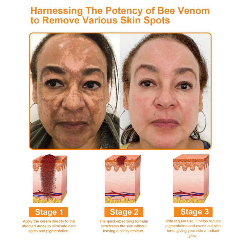 Powerful All-Body Skin Treatment Cream [👑Official Store]