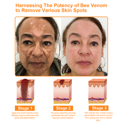 Powerful All-Body Skin Treatment Cream [👑Official Store]