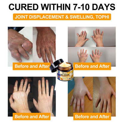 Official Store: Aetheris™ Bee Venom Instant Ultra Strength Pain Relief Therapy Cream-(Provides pain eliminate for Arthritis, Muscle, Back Pain, Knees, Back, Shoulders, Hips, Wrists, Hands)