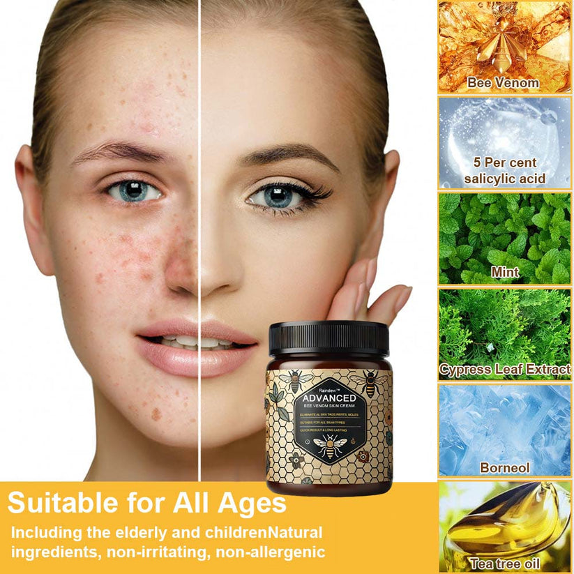 Advanced Bee Venom Skin Cream👨‍⚕️🌿(🔥𝑳𝒂𝒔𝒕 𝒅𝒂𝒚 𝒑𝒓𝒐𝒎𝒐𝒕𝒊𝒐𝒏 8𝟎% 𝒐𝒇𝒇)
