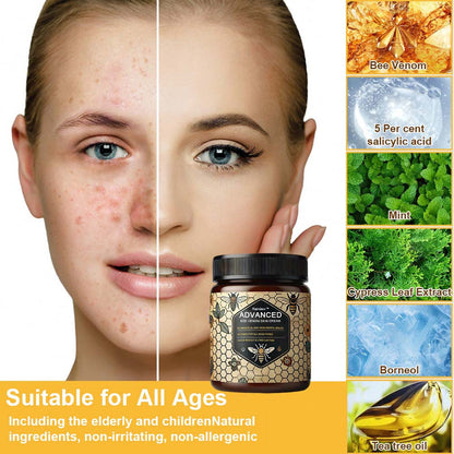 Advanced Bee Venom Skin Cream👨‍⚕️🌿(🔥𝑳𝒂𝒔𝒕 𝒅𝒂𝒚 𝒑𝒓𝒐𝒎𝒐𝒕𝒊𝒐𝒏 8𝟎% 𝒐𝒇𝒇)