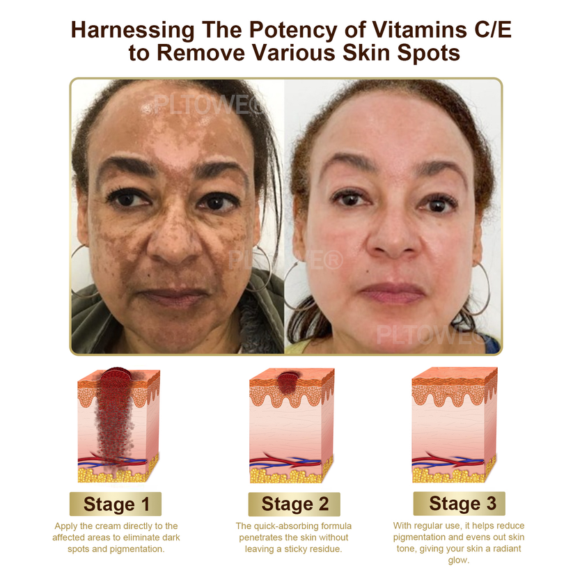 Powerful All-Body Skin Treatment Cream (BIGGEST DISCOUNT)