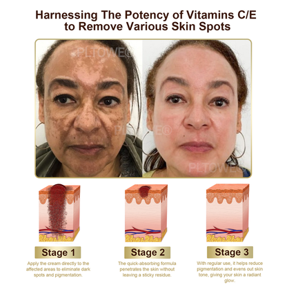 Powerful All-Body Skin Treatment Cream (BIGGEST DISCOUNT)