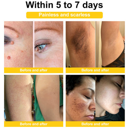 Bee Venom Skin Cream🔥𝑳𝒂𝒔𝒕 𝒅𝒂𝒚 𝒑𝒓𝒐𝒎𝒐𝒕𝒊𝒐𝒏 7𝟎% 𝒐𝒇𝒇