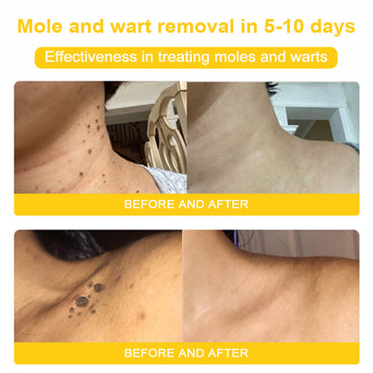 Bee Venom Skin Cream🔥𝑳𝒂𝒔𝒕 𝒅𝒂𝒚 𝒑𝒓𝒐𝒎𝒐𝒕𝒊𝒐𝒏 7𝟎% 𝒐𝒇𝒇