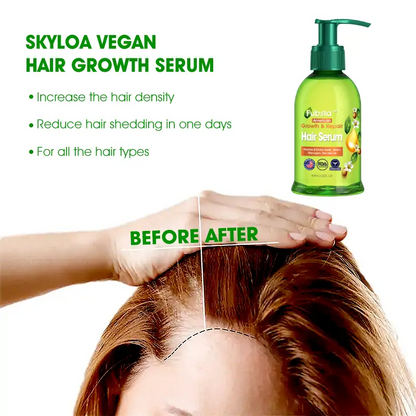 Scalp Treatment HairGrᴏᴡth Serum (Hurry, 80% OFF - Only 30 minutes left 🫧)