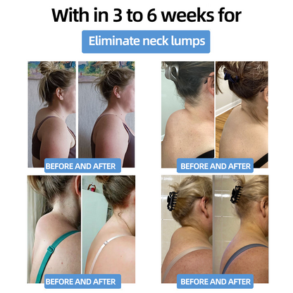 𝗣𝗼𝗿𝘁𝗮𝗯𝗹𝗲 𝗟𝘆𝗺𝗽𝗵𝗮𝘁𝗶𝗰 𝗦𝗼𝗼𝘁𝗵𝗶𝗻𝗴 𝗕𝗼𝗱𝘆 𝗦𝗵𝗮𝗽𝗶𝗻𝗴 𝗨𝗹𝘁𝗿𝗮𝘀𝗼𝘂𝗻𝗱 𝗜𝗻𝘀𝘁𝗿𝘂𝗺𝗲𝗻𝘁 𝗳𝗼𝗿 𝗡𝗲𝗰𝗸