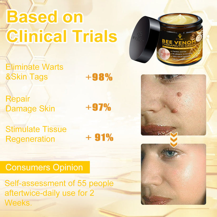 Bee Venom Skin Cream🔥𝑳𝒂𝒔𝒕 𝒅𝒂𝒚 𝒑𝒓𝒐𝒎𝒐𝒕𝒊𝒐𝒏 7𝟎% 𝒐𝒇𝒇