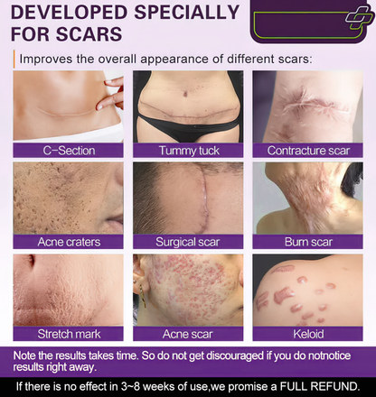 [Limited time discount sale🔥] Advanced Scar Gel