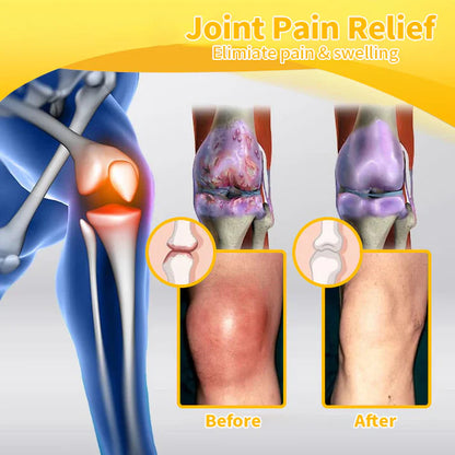 Bee-Venom Pain Relief Bone Healing Cream