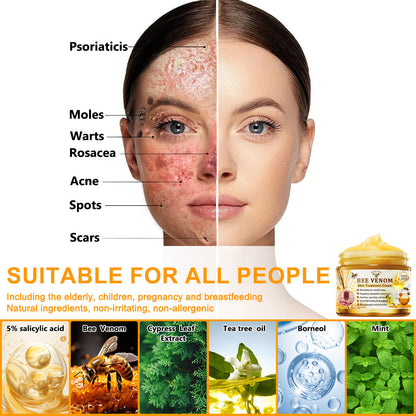 Bee Venom Skin Treatment Cream (👨‍⚕Suitable for all skin types - Last 30 mins 80% off)
