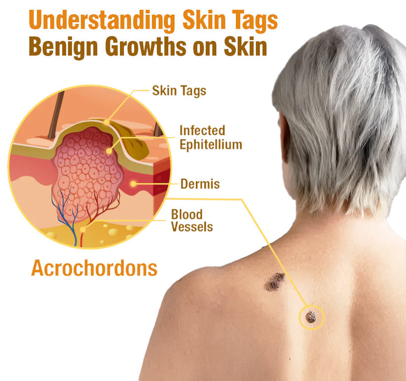 Advanced Bee Venom Skin Cream👨‍⚕️🌿(🔥𝑳𝒂𝒔𝒕 𝒅𝒂𝒚 𝒑𝒓𝒐𝒎𝒐𝒕𝒊𝒐𝒏 8𝟎% 𝒐𝒇𝒇)