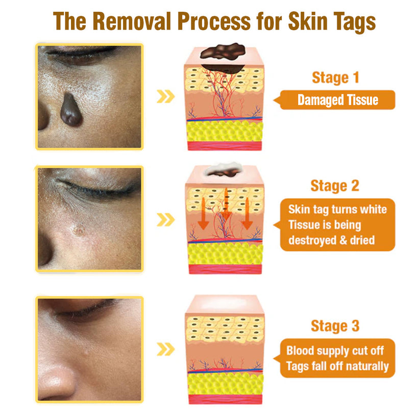 Advanced Bee Venom Skin Cream👨‍⚕️🌿(🔥𝑳𝒂𝒔𝒕 𝒅𝒂𝒚 𝒑𝒓𝒐𝒎𝒐𝒕𝒊𝒐𝒏 8𝟎% 𝒐𝒇𝒇)