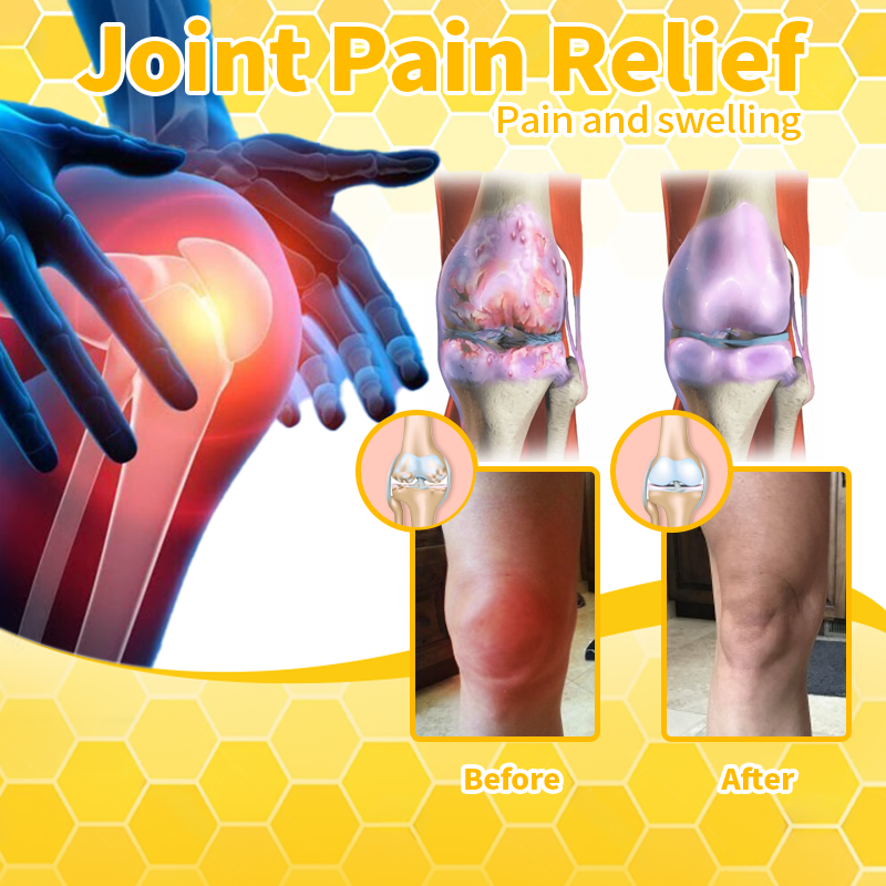 Bee Venom & Turmeric Arthritis Therapy Cream 👩‍🔬Specializing in orthopedic conditions and joint pain