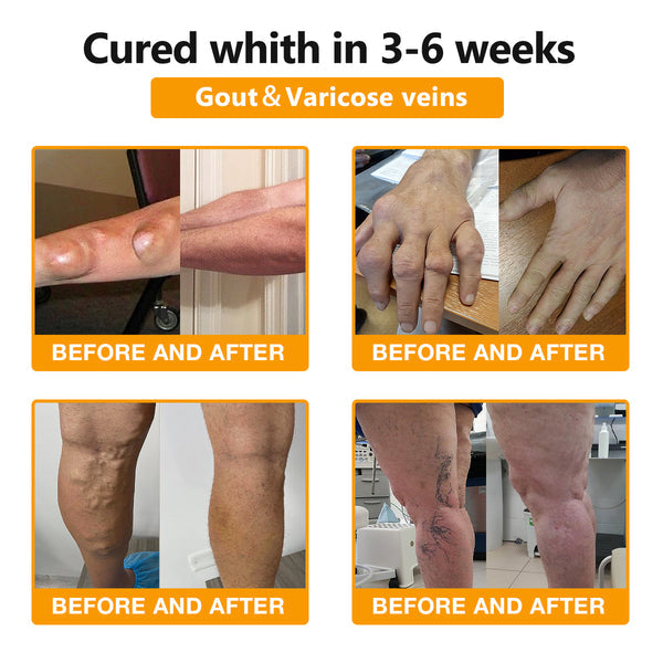 Bee Venom & Turmeric Arthritis Therapy Cream 👩‍🔬Specializing in orthopedic conditions and joint pain