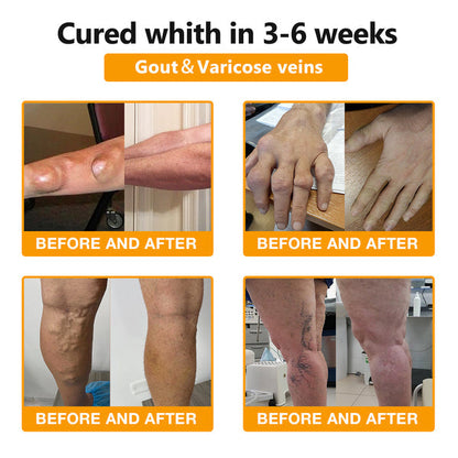Bee Venom & Turmeric Arthritis Therapy Cream 👩‍🔬Specializing in orthopedic conditions and joint pain